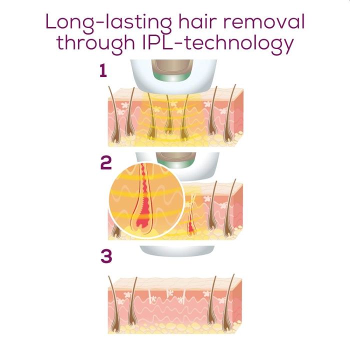 Beurer IPL 5800 PureSkin Pro Hair-remover